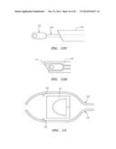 METHODS AND DEVICES FOR DELIVERY OF PROSTHETIC HEART VALVES AND OTHER     PROSTHETICS diagram and image