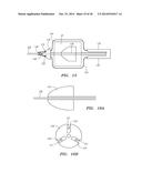 METHODS AND DEVICES FOR DELIVERY OF PROSTHETIC HEART VALVES AND OTHER     PROSTHETICS diagram and image