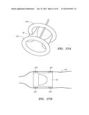 METHODS AND DEVICES FOR DELIVERY OF PROSTHETIC HEART VALVES AND OTHER     PROSTHETICS diagram and image