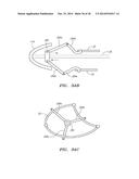 METHODS AND DEVICES FOR DELIVERY OF PROSTHETIC HEART VALVES AND OTHER     PROSTHETICS diagram and image