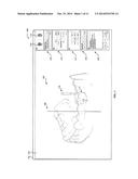 DENTAL RESTORATION diagram and image