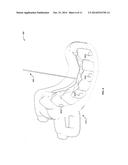 DENTAL RESTORATION diagram and image