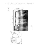 DENTAL RESTORATION diagram and image