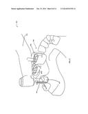 DENTAL RESTORATION diagram and image