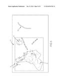 Catheter configuration interface and related system diagram and image