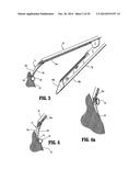 DISSECTING TIP FOR SURGICAL STAPLER diagram and image