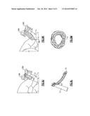 HAND HELD LINK MAKING DEVICE AND KIT diagram and image