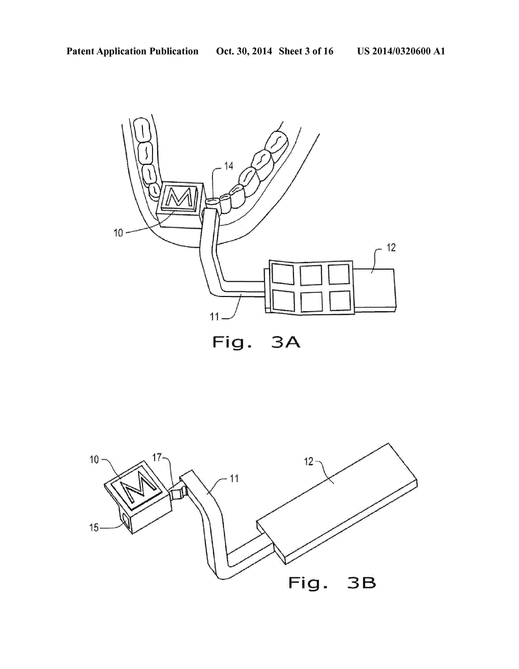 SYSTEM AND METHOD FOR TRACKING NON-VISIBLE STRUCTURE OF A BODY - diagram, schematic, and image 04