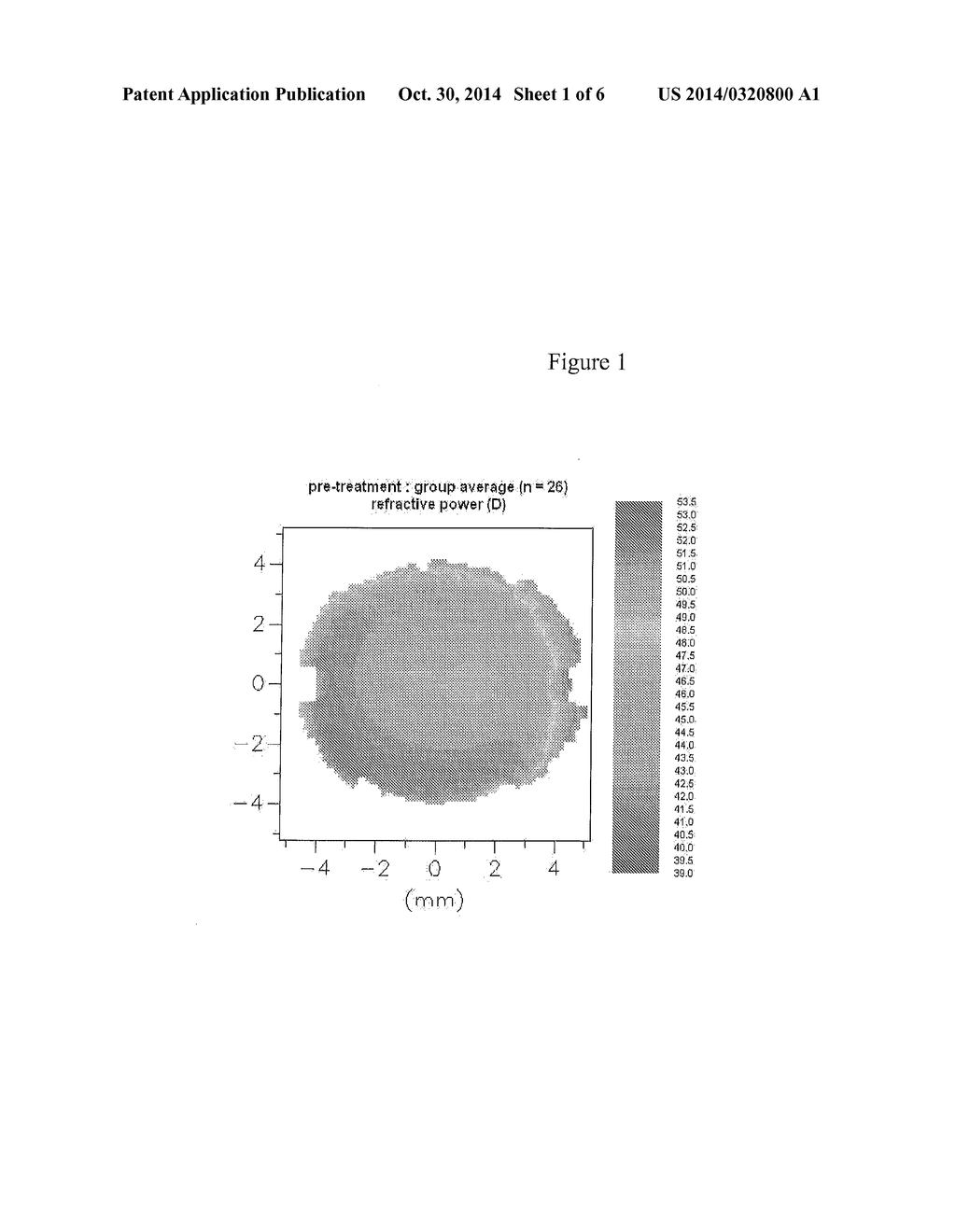 DESIGN OF MYOPIA CONTROL OPHTHALMIC LENSES - diagram, schematic, and image 02