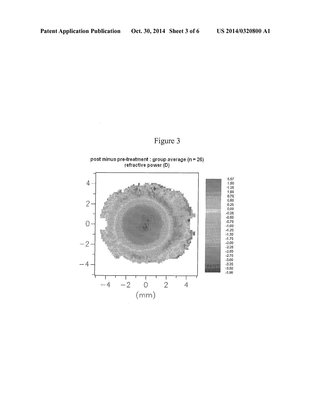 DESIGN OF MYOPIA CONTROL OPHTHALMIC LENSES - diagram, schematic, and image 04