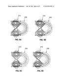 Magnetically Contained Energized Plasma diagram and image