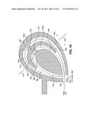 COMPACT, INTERLEAVED RADIATION SOURCES diagram and image