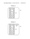 MOBILE RADIATION GENERATING APPARATUS AND RADIATION IMAGING SYSTEM diagram and image