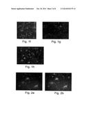 METHODS OF GENERATING GLIAL AND NEURONAL CELLS AND USE OF SAME FOR THE     TREATMENT OF MEDICAL CONDITIONS OF THE CNS diagram and image