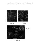 METHODS OF GENERATING GLIAL AND NEURONAL CELLS AND USE OF SAME FOR THE     TREATMENT OF MEDICAL CONDITIONS OF THE CNS diagram and image