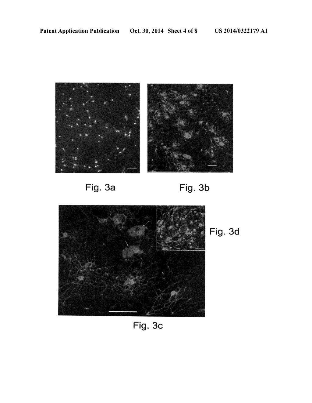 METHODS OF GENERATING GLIAL AND NEURONAL CELLS AND USE OF SAME FOR THE     TREATMENT OF MEDICAL CONDITIONS OF THE CNS - diagram, schematic, and image 05