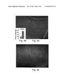 METHODS OF GENERATING GLIAL AND NEURONAL CELLS AND USE OF SAME FOR THE     TREATMENT OF MEDICAL CONDITIONS OF THE CNS diagram and image