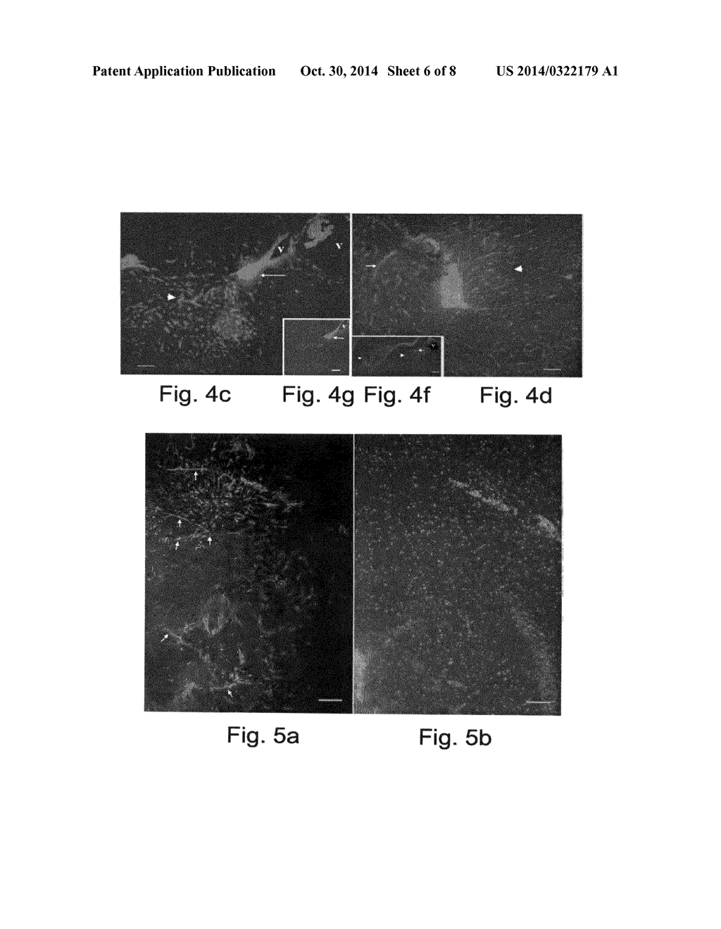 METHODS OF GENERATING GLIAL AND NEURONAL CELLS AND USE OF SAME FOR THE     TREATMENT OF MEDICAL CONDITIONS OF THE CNS - diagram, schematic, and image 07