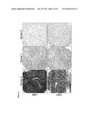 Analysis and Targeting of ROR2 in Cancer diagram and image