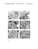 SECOND GENERATION VIRUS-LIKE PARTICLES (VLP) FROM EPSTEIN-BARR VIRUSES FOR     VACCINATION PURPOSES diagram and image