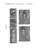 Compositions for Preventing or Treating Adverse Reactions of EGFR     Inhibition diagram and image