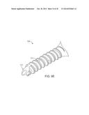 METHOD AND DEVICE FOR CAUSING TOOTH MOVEMENT diagram and image