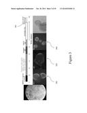 FUNCTIONAL RECOVERY OF HUMAN LUNGS FOR TRANSPLANTATION diagram and image