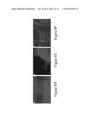 FUNCTIONAL RECOVERY OF HUMAN LUNGS FOR TRANSPLANTATION diagram and image