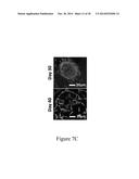 FUNCTIONAL RECOVERY OF HUMAN LUNGS FOR TRANSPLANTATION diagram and image