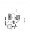 FUNCTIONAL RECOVERY OF HUMAN LUNGS FOR TRANSPLANTATION diagram and image