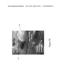 FUNCTIONAL RECOVERY OF HUMAN LUNGS FOR TRANSPLANTATION diagram and image