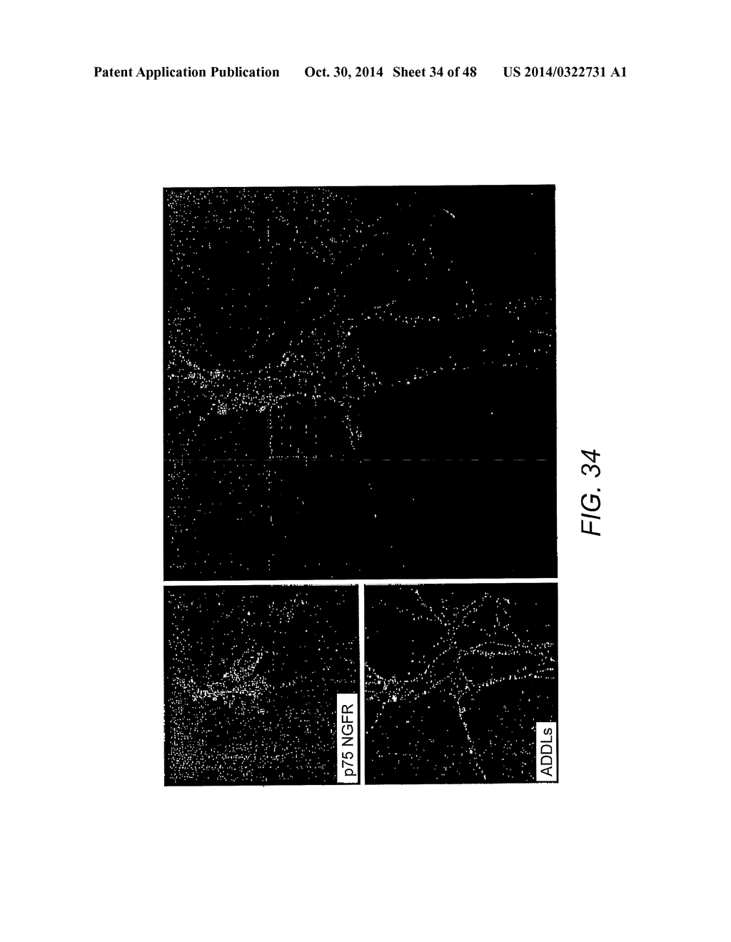 AMYLOID BETA-DERIVED DIFFUSIBLE LIGANDS (ADDLs), ADDL-BINDING MOLECULES,     AND USES THEREOF - diagram, schematic, and image 35