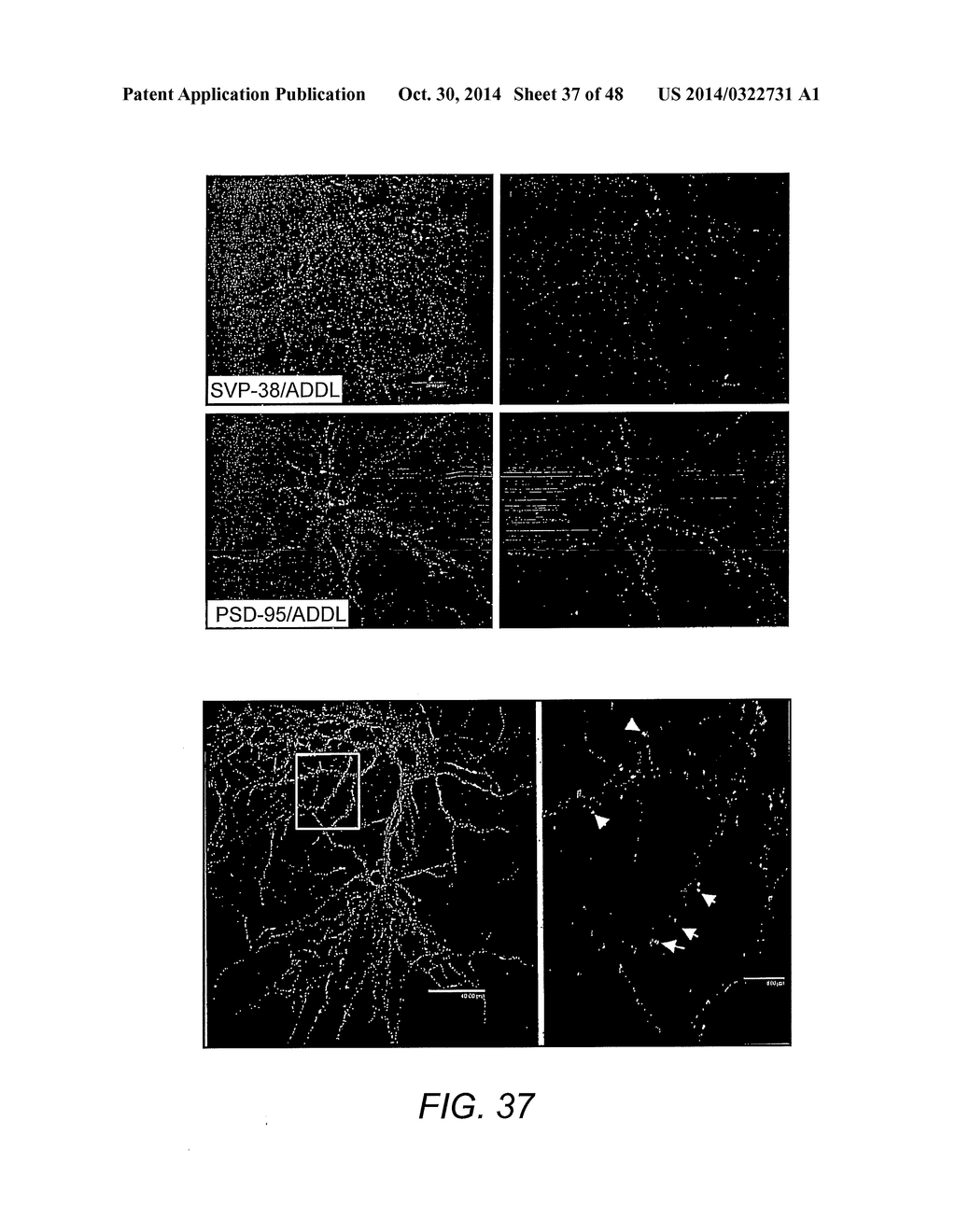 AMYLOID BETA-DERIVED DIFFUSIBLE LIGANDS (ADDLs), ADDL-BINDING MOLECULES,     AND USES THEREOF - diagram, schematic, and image 38