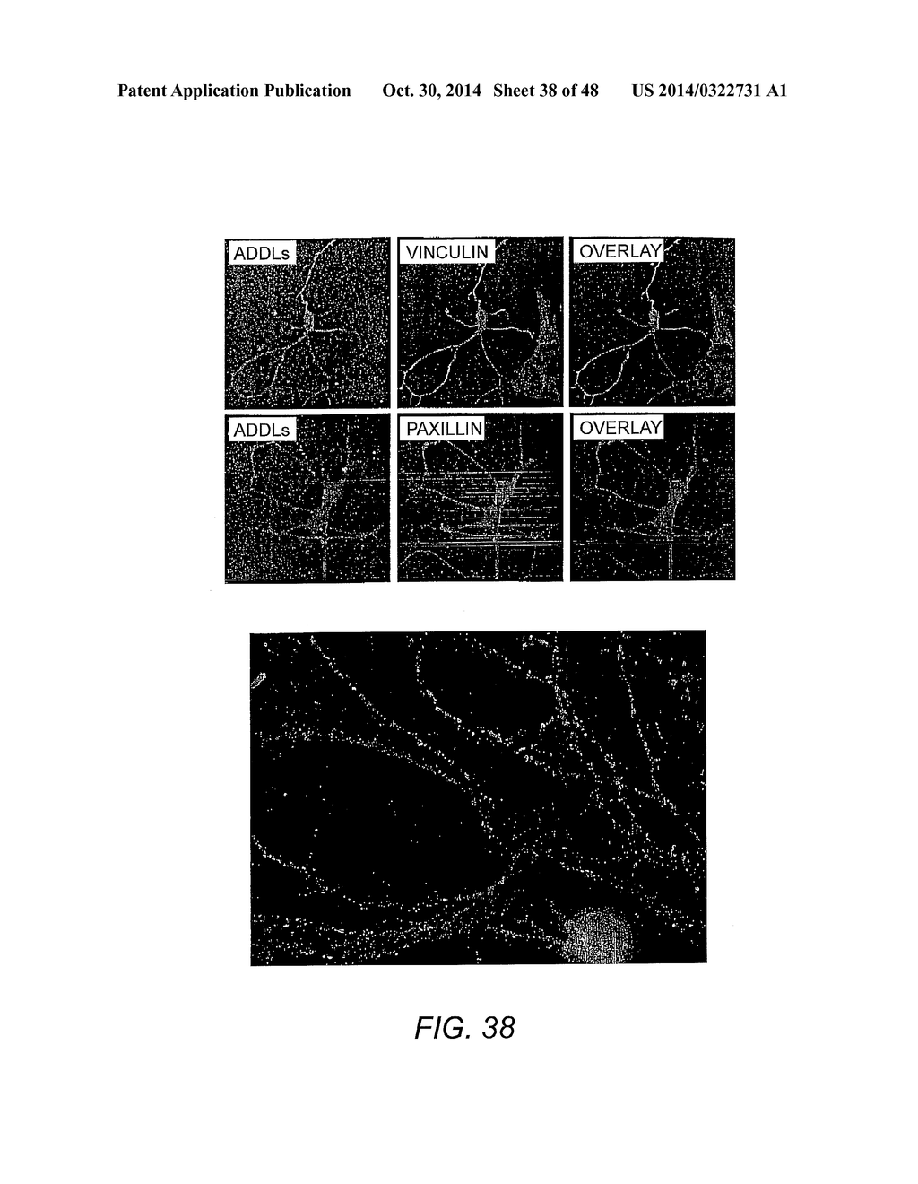 AMYLOID BETA-DERIVED DIFFUSIBLE LIGANDS (ADDLs), ADDL-BINDING MOLECULES,     AND USES THEREOF - diagram, schematic, and image 39