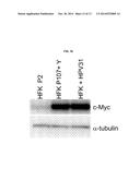 Use of a Rock Inhibitor to Sustain Primary Human Keratinocytes in a     Proliferative State diagram and image