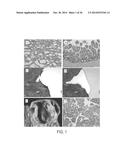 Differential Identification of Pancreatic Cysts diagram and image