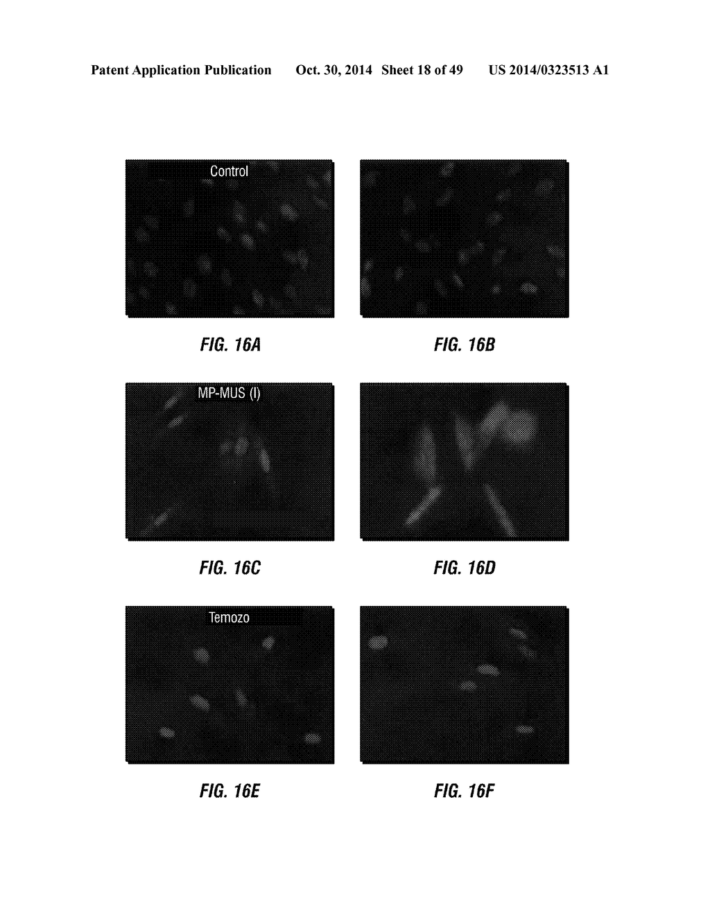 Chemotherapeutic Compositions and Methods for Treating Human Gliomas - diagram, schematic, and image 19