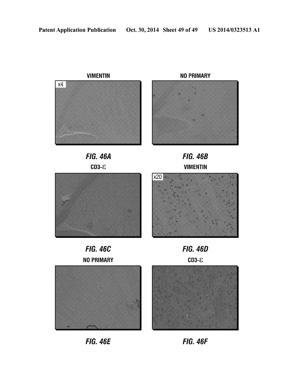 Chemotherapeutic Compositions and Methods for Treating Human Gliomas - diagram, schematic, and image 50