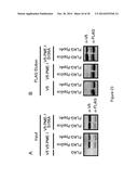 PME-1 AS A BIOMARKER TO PREDICT AND DIAGNOSE AN INCREASED RISK OF     ENDOMETRIAL CANCER AND GENE SILENCING OF PME-1 TO INHIBIT EPITHELIAL TO     MESENCHYMAL TRANSITION diagram and image