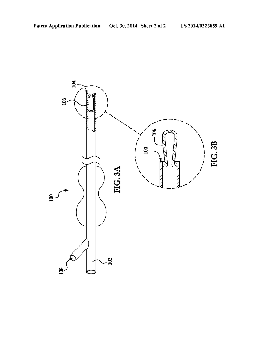 DEVICE AND PROCESS TO CONFIRM OCCLUSION OF THE FALLOPIAN TUBE - diagram, schematic, and image 03