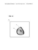 SYSTEMS, METHODS, AND INTERFACES FOR IDENTIFYING OPTIMAL ELECTRICAL     VECTORS diagram and image