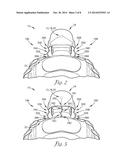 DEVICE AND SYSTEM TO REDUCE TRAUMATIC BRAIN INJURY diagram and image