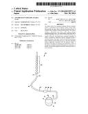 ANCHOR SLEEVE FOR IMPLANTABLE LEAD diagram and image