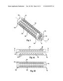 ANCHOR SLEEVE FOR IMPLANTABLE LEAD diagram and image