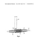 ANCHOR SLEEVE FOR IMPLANTABLE LEAD diagram and image