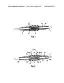 ANCHOR SLEEVE FOR IMPLANTABLE LEAD diagram and image