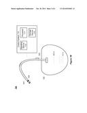 CATHETER diagram and image