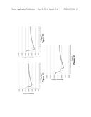 CATHETER diagram and image