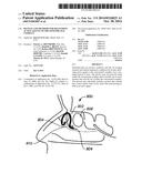 DEVICES AND METHODS FOR DELIVERING ACTIVE AGENTS TO THE OSTEOMEATAL     COMPLEX diagram and image