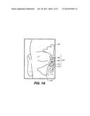 DEVICES AND METHODS FOR DELIVERING ACTIVE AGENTS TO THE OSTEOMEATAL     COMPLEX diagram and image